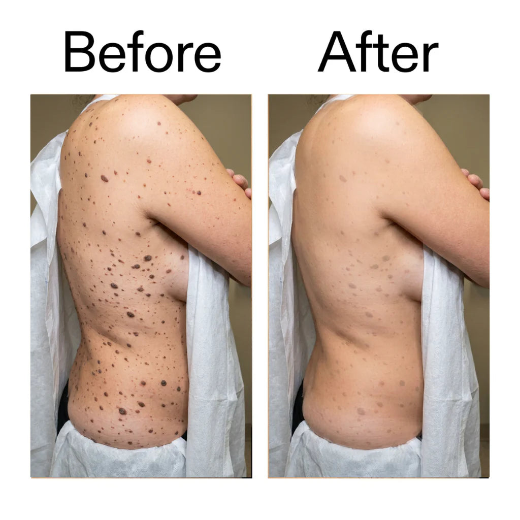 Smooth & Even Glycolic Body Stick