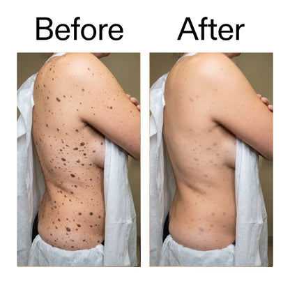 Smooth & Even Glycolic Body Stick